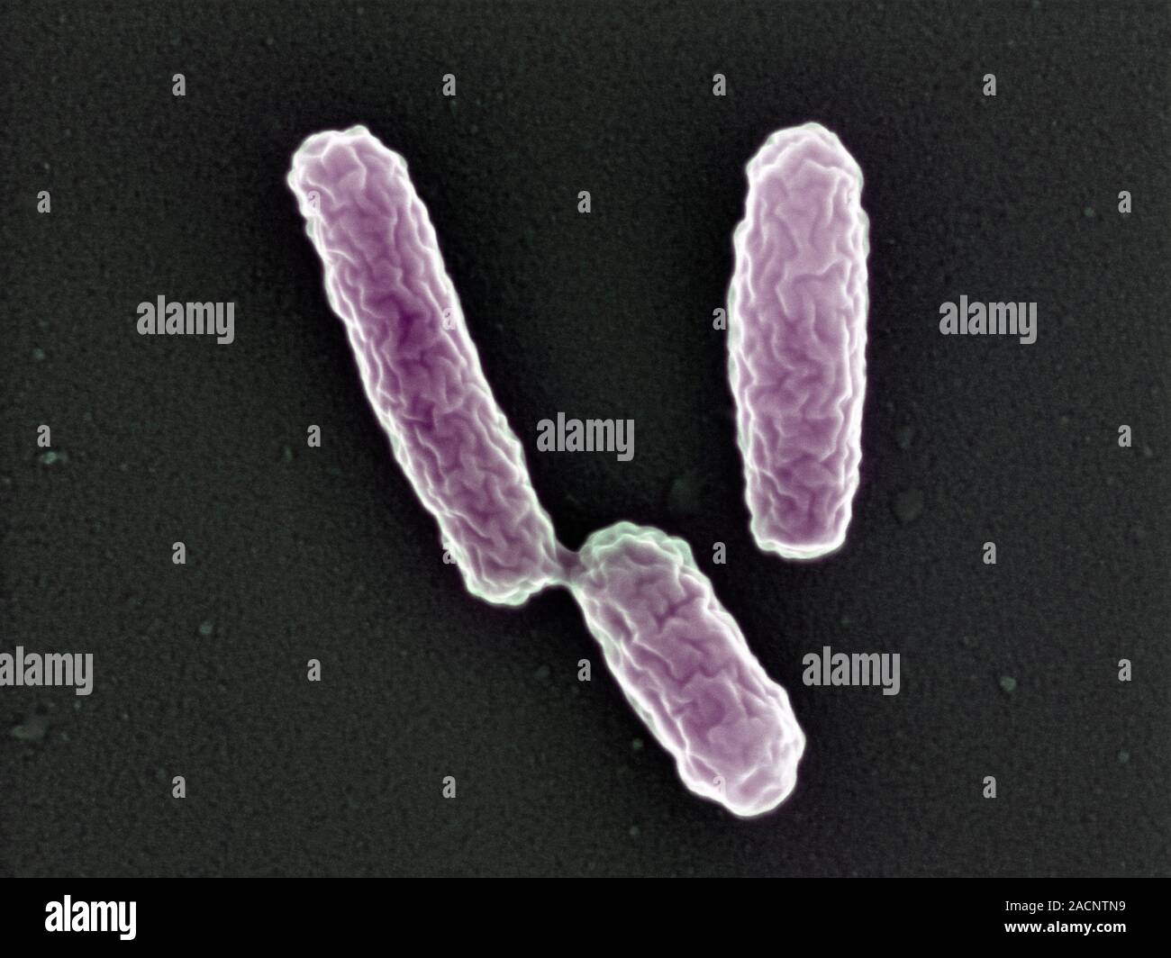 Legionella bacteria. Coloured scanning electron micrograph (SEM) of Legionella pneumophila, the