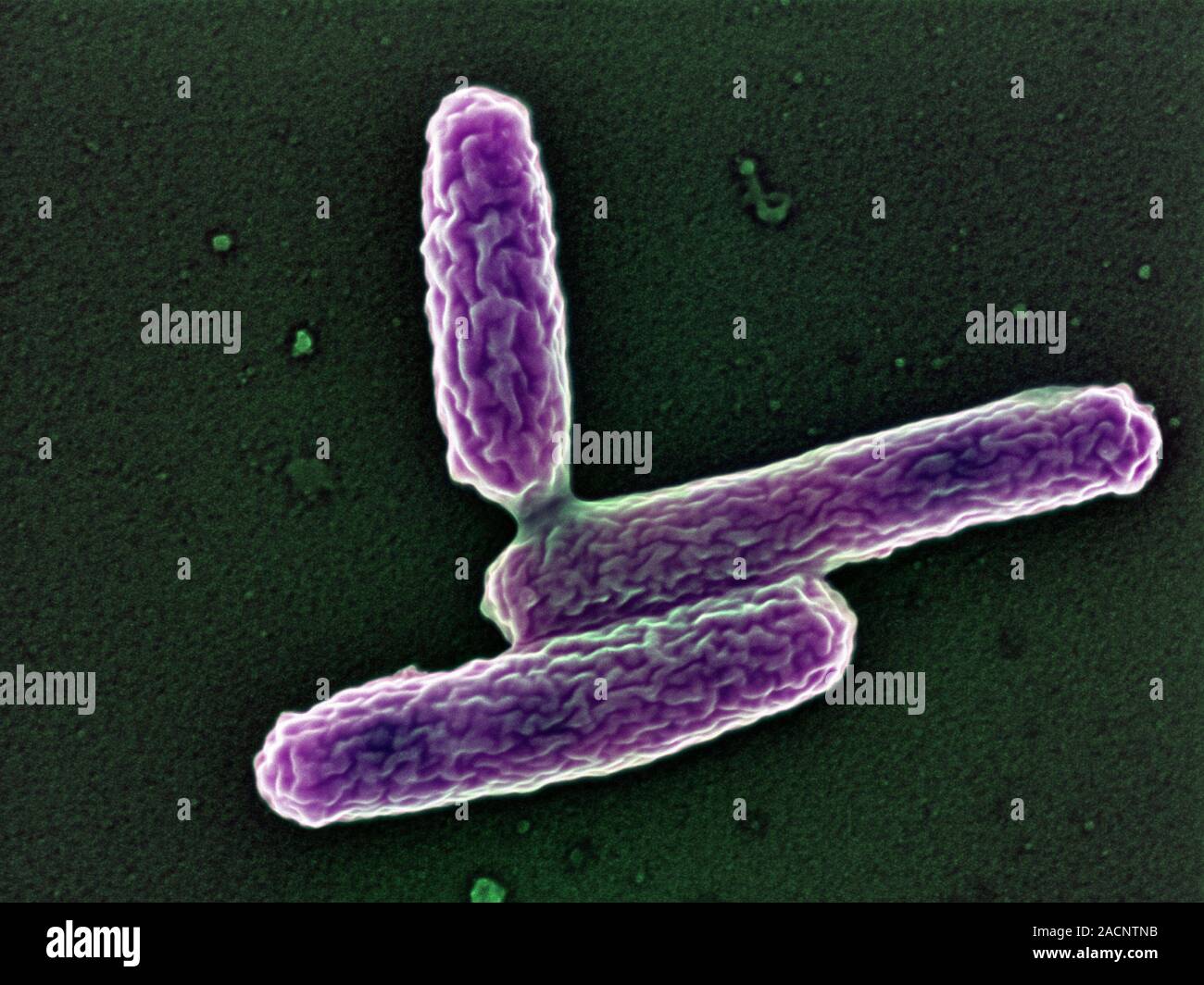Legionella bacteria. Coloured scanning electron micrograph (SEM) of Legionella pneumophila, the