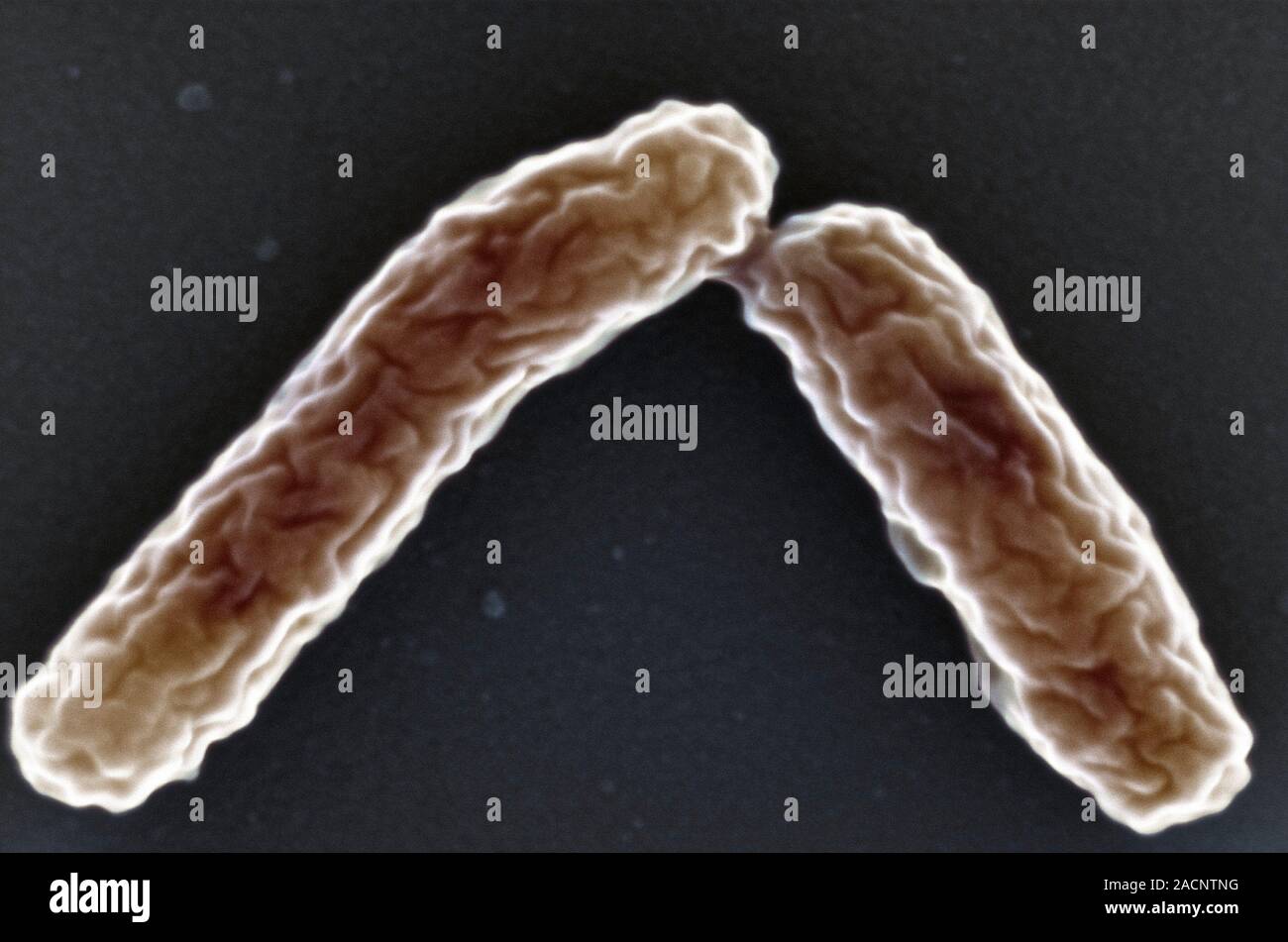 Legionella bacteria. Coloured scanning electron micrograph (SEM) of Legionella pneumophila, the