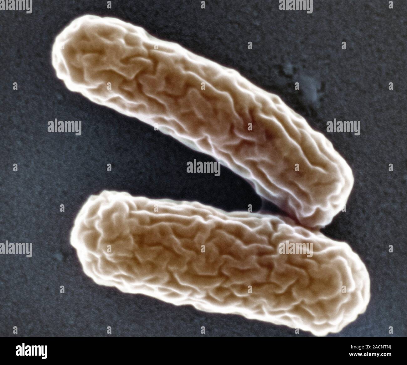 Legionella bacteria. Coloured scanning electron micrograph (SEM) of Legionella pneumophila, the