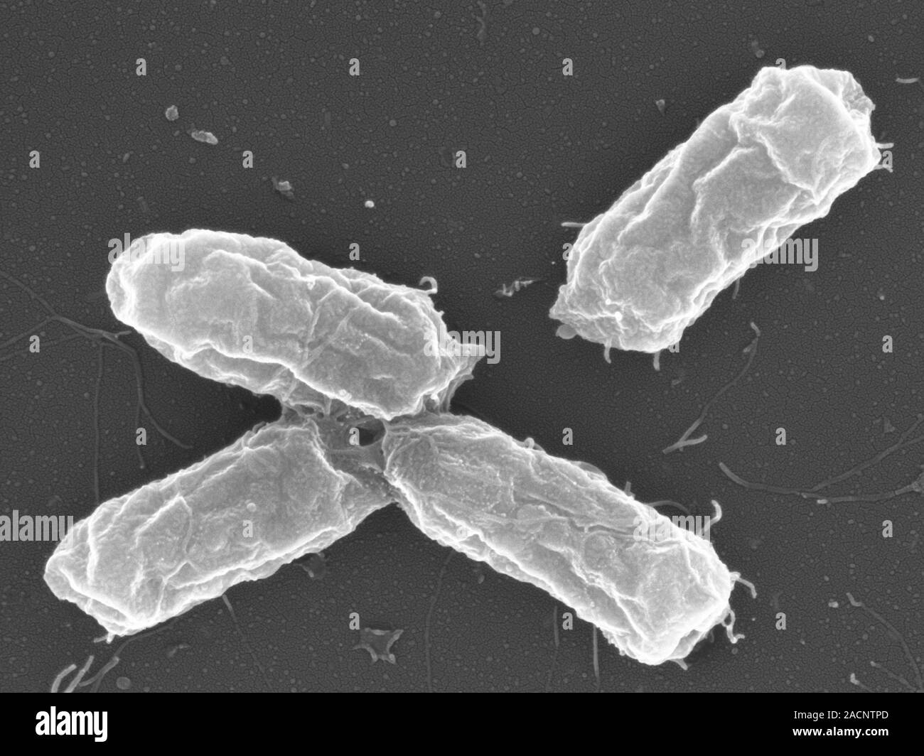 Salmonella bacteria. Scanning electron micrograph (SEM) of Salmonella paratyphi bacteria. These