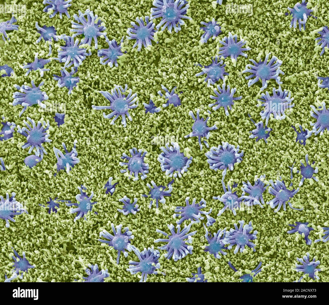Nasal lining. Coloured scanning electron micrograph (SEM) of the ...