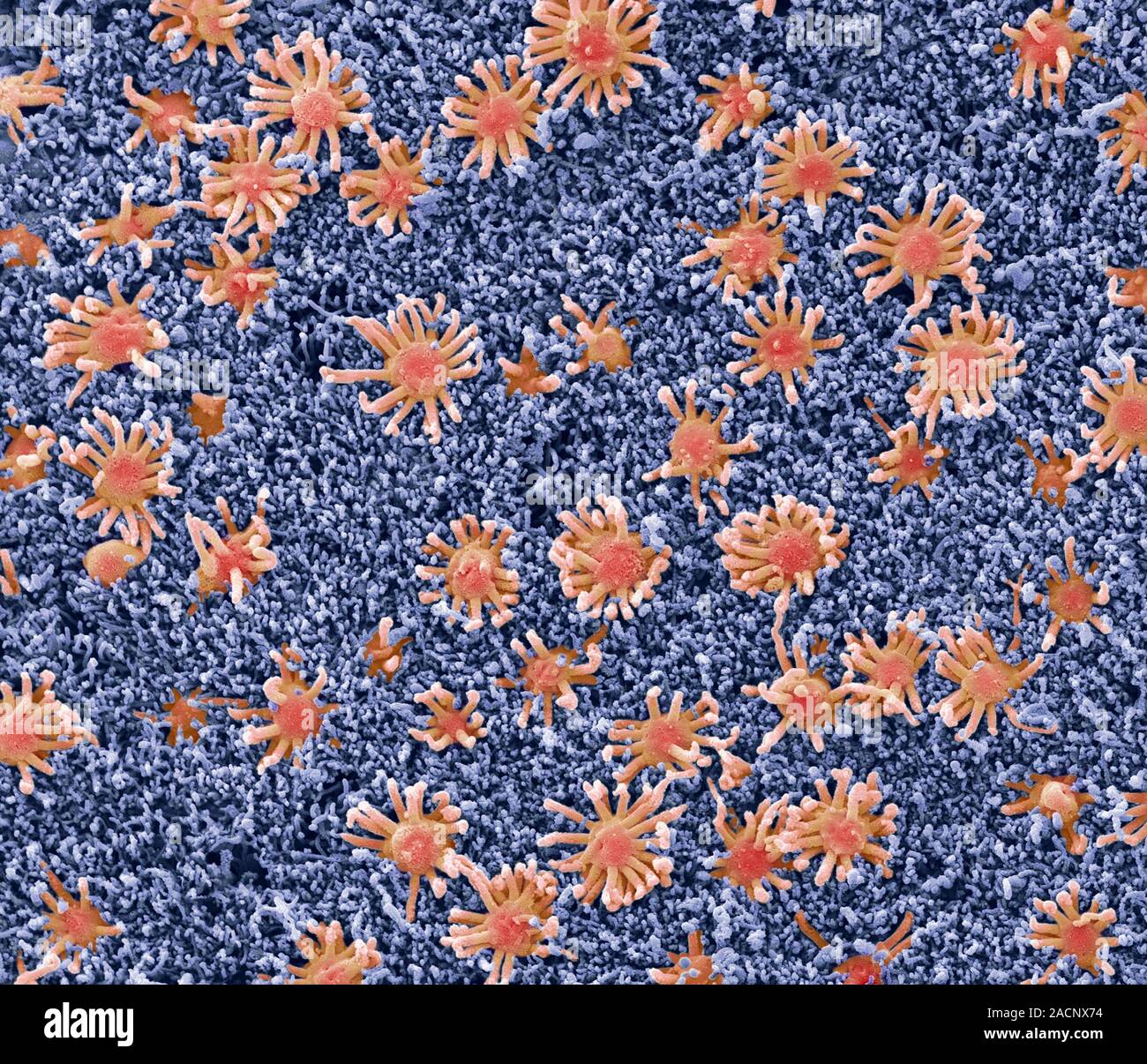 Nasal lining. Coloured scanning electron micrograph (SEM) of the ...