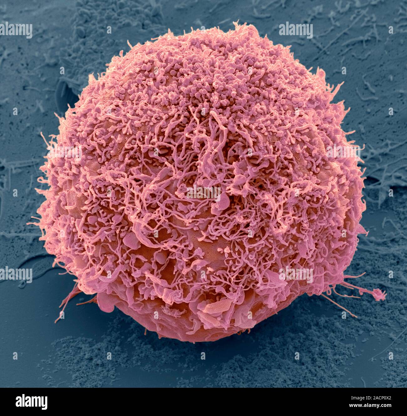 Mesenchymal stem cell. Coloured scanning electron micrograph (SEM) of a