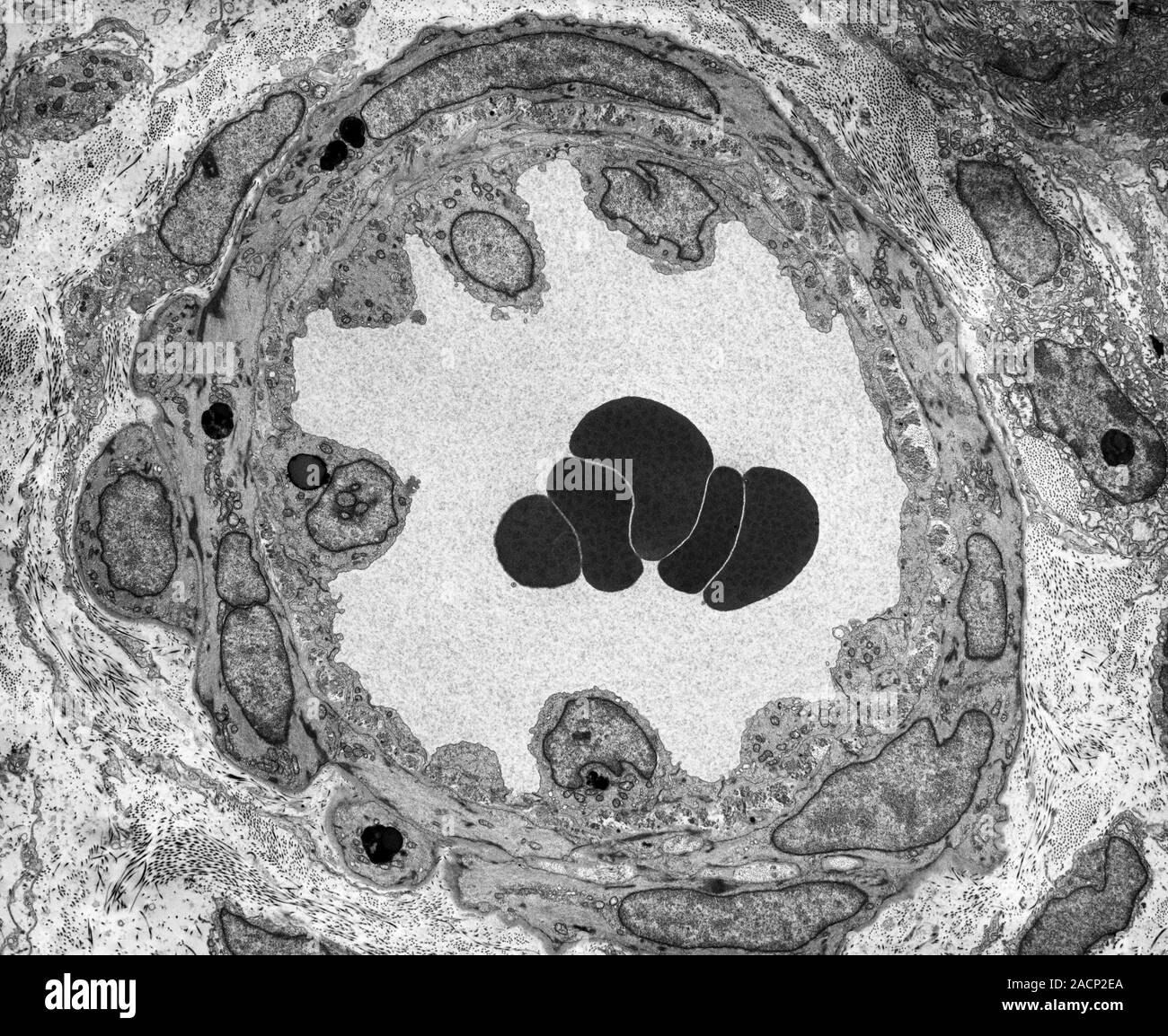 Arteriole. Transmission electron micrograph (TEM) of a section through ...