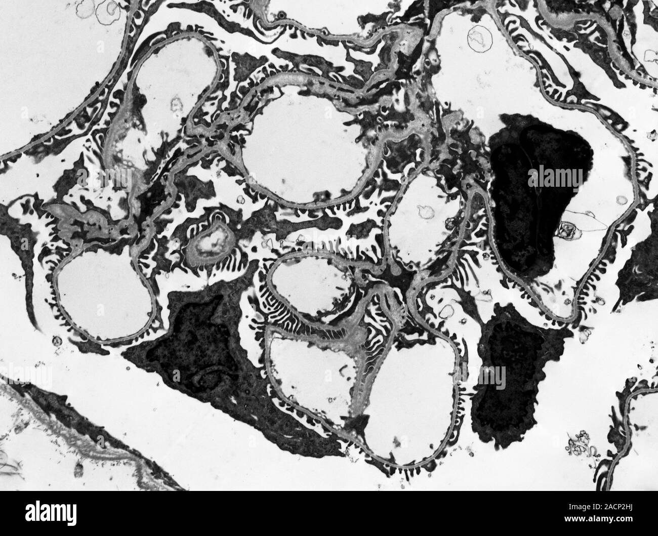 Glomerulus. Transmission electron micrograph (TEM) of a section through