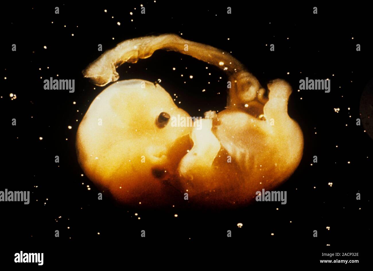 Macrophoto of a healthy human embryo aged 7 weeks, measuring about 3cm ...