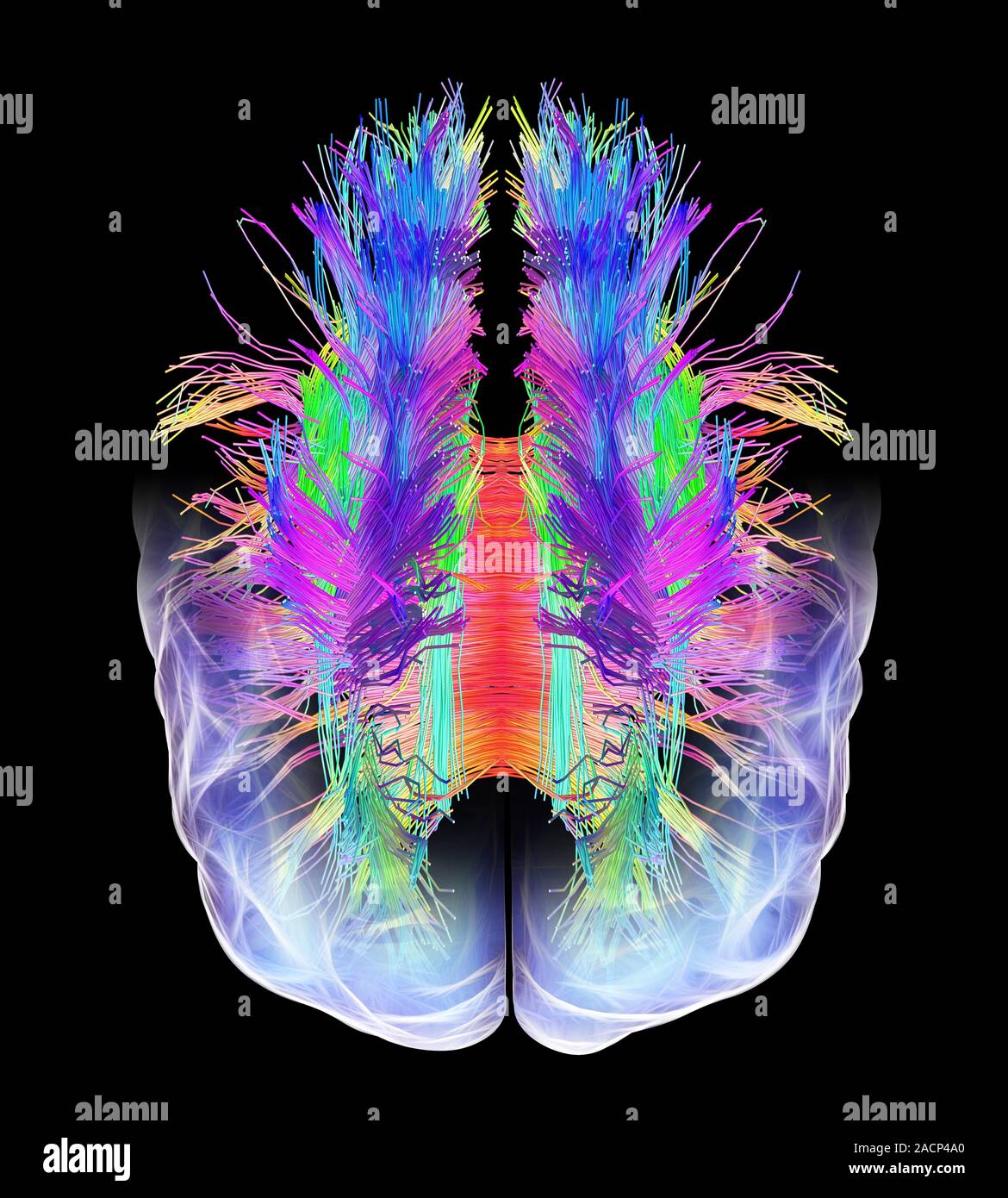 White matter fibres overlaid a 3d model of the human brain in top view ...