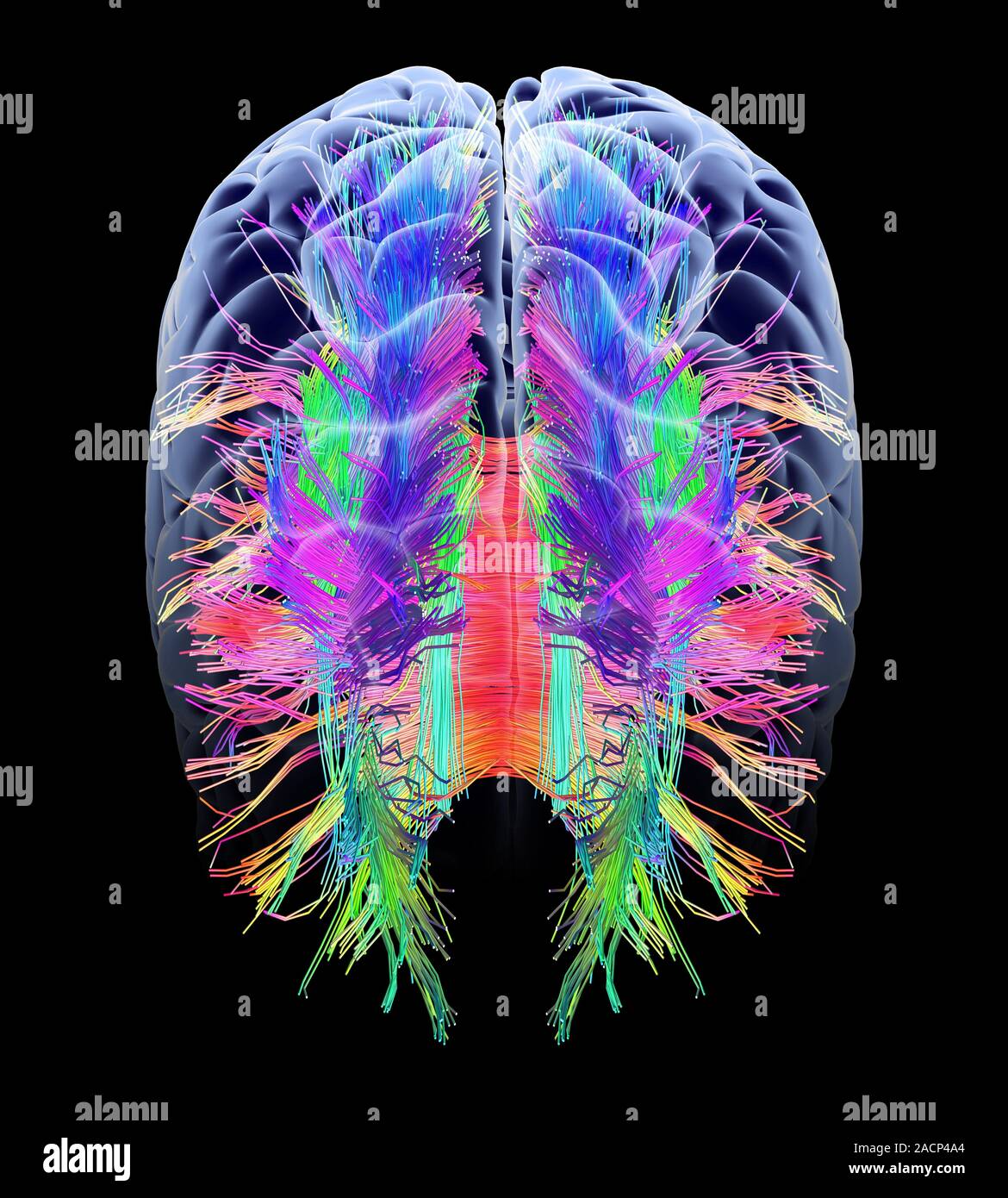 White matter fibres overlaid a 3d model of the human brain in top view ...