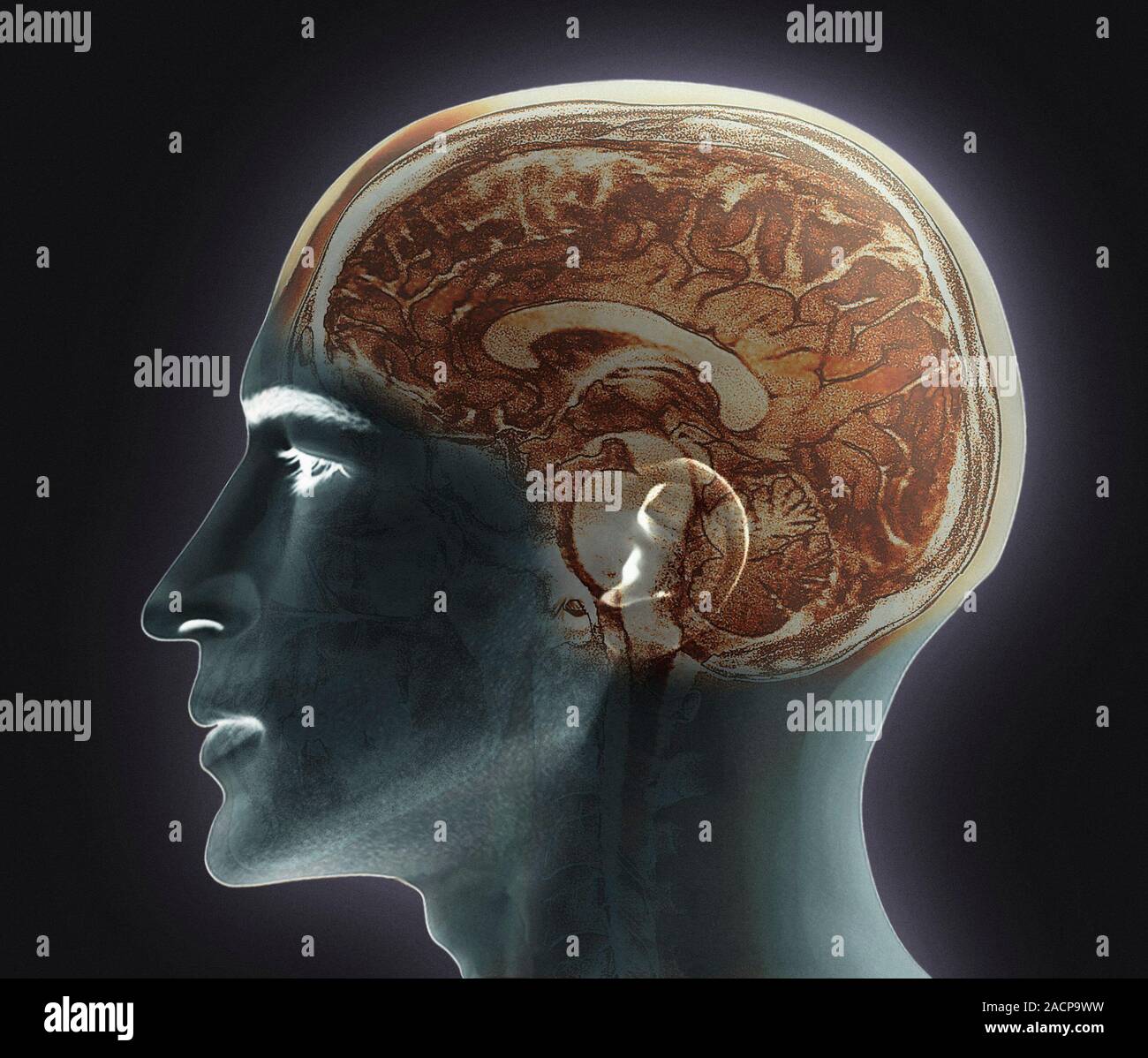 Normal human brain. Coloured magnetic resonance imaging (MRI) scan of a ...