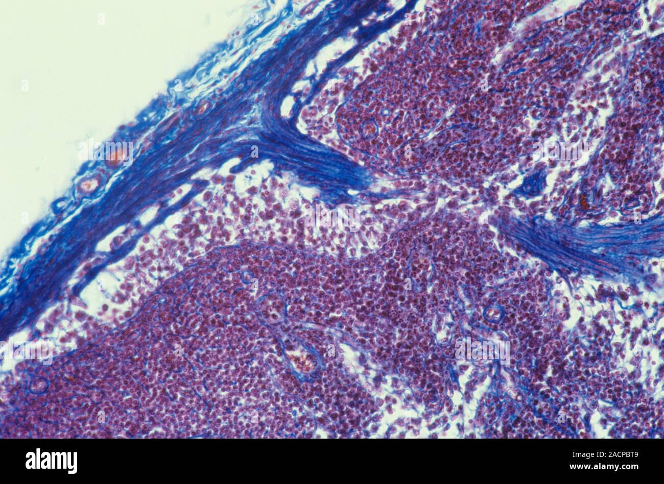 Lymph node. Light micrograph of a section through a lymph node. The ...