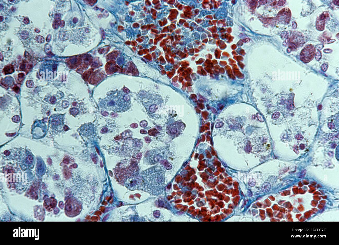 Pituitary gland. Light micrograph of a section through a healthy