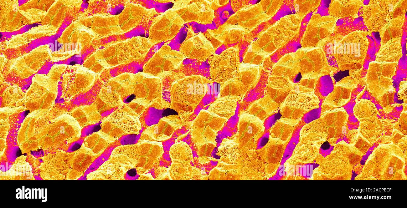 Liver vein. Coloured scanning electron micrograph (SEM) of liver tissue ...
