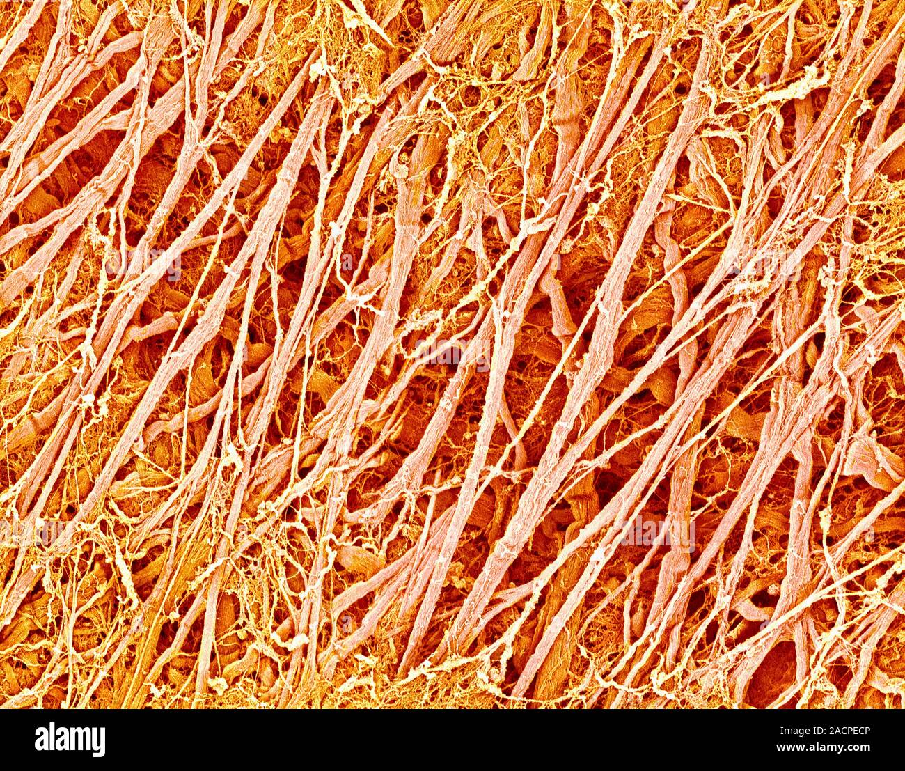 Connective tissue. Coloured scanning electron micrograph (SEM) of