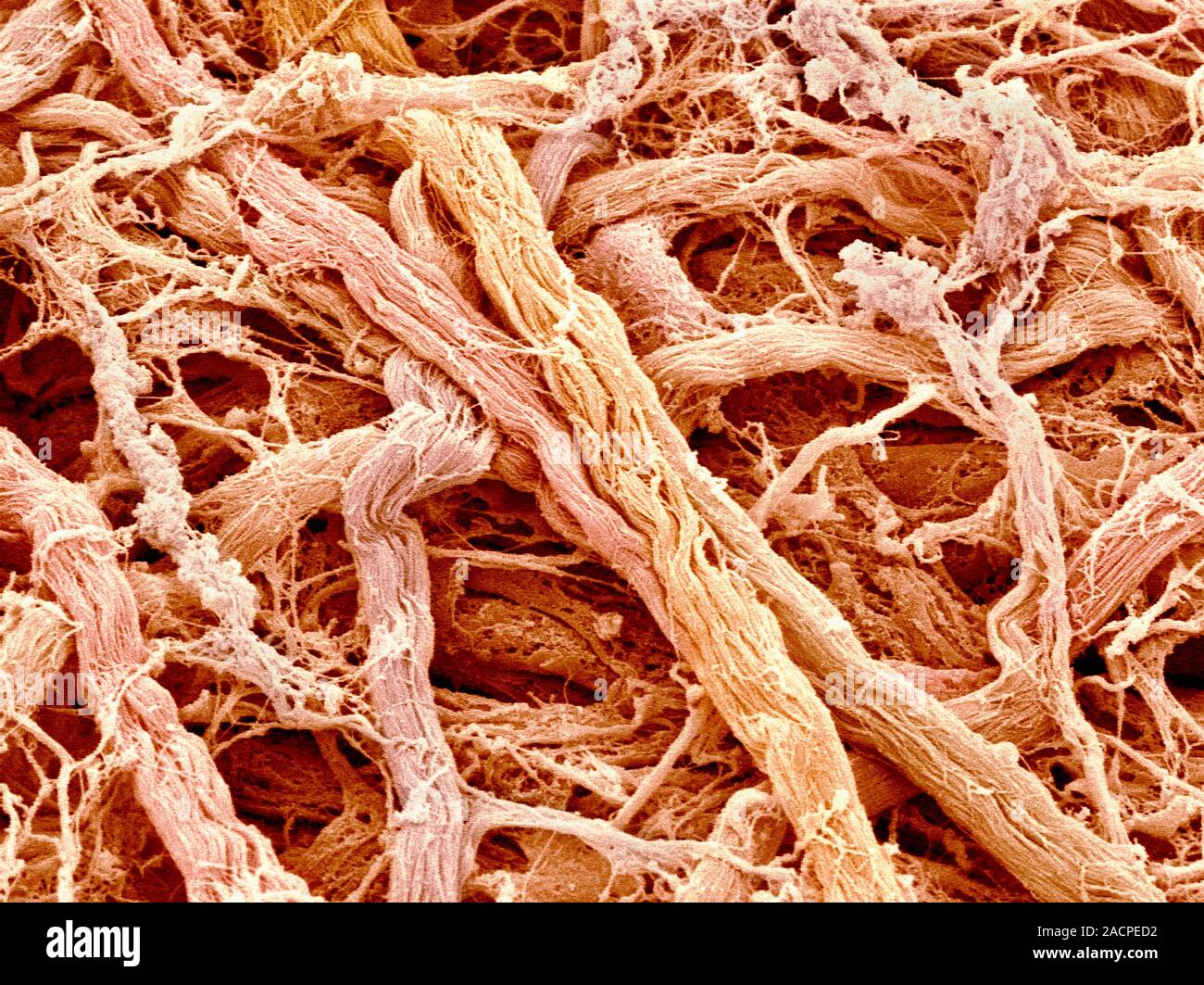 Connective tissue. Coloured scanning electron micrograph (SEM) of