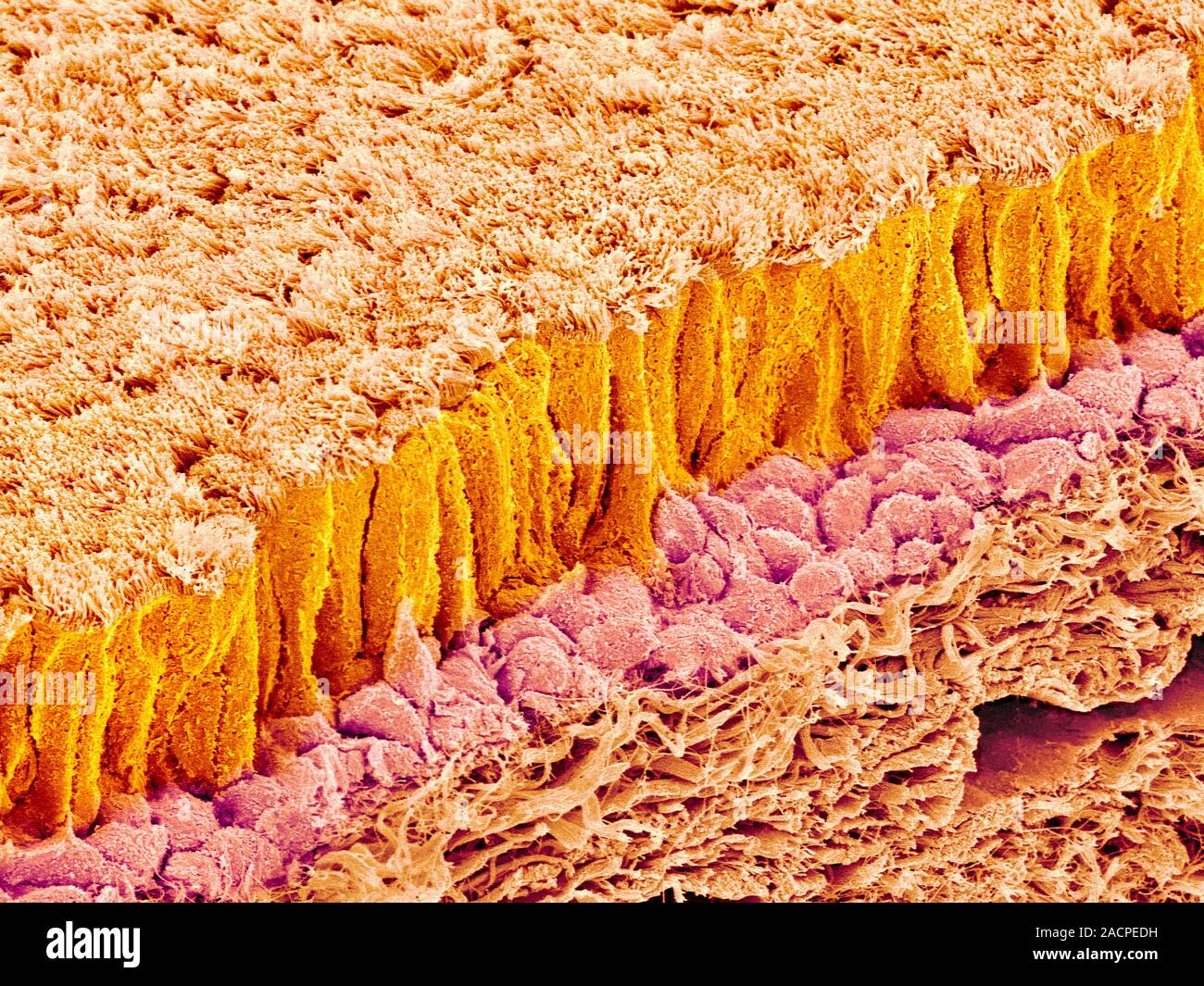 Trachea lining. Coloured scanning electron micrograph (SEM) of a ...