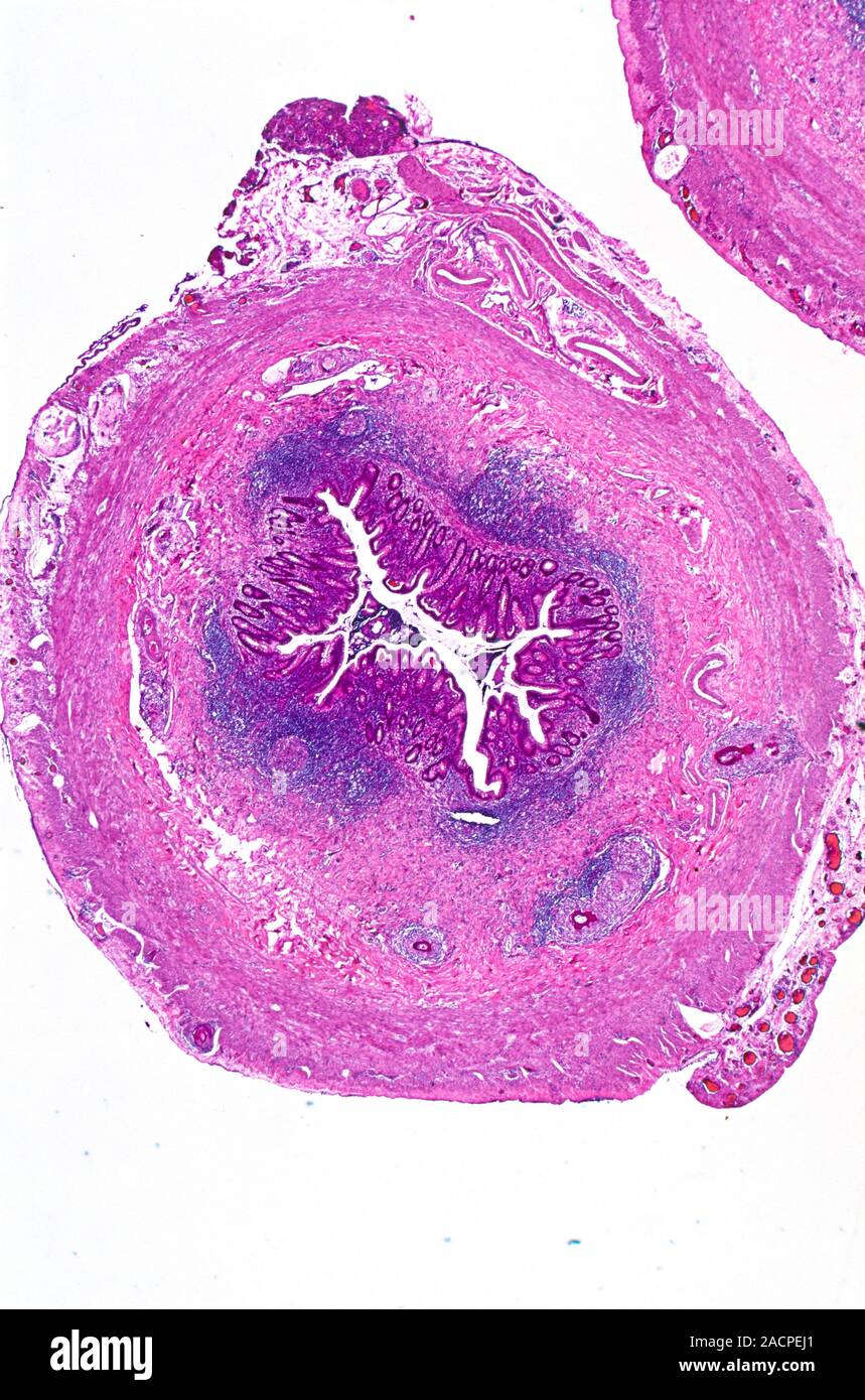 Appendix. Light micrograph of a section through a human appendix. The