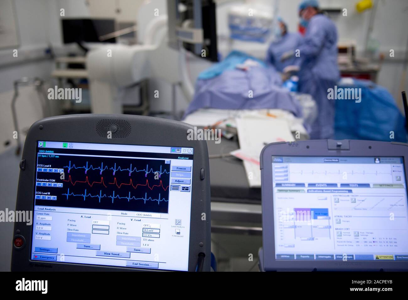 Implantable defibrillator surgery. Surgeons performing surgery to fit a
