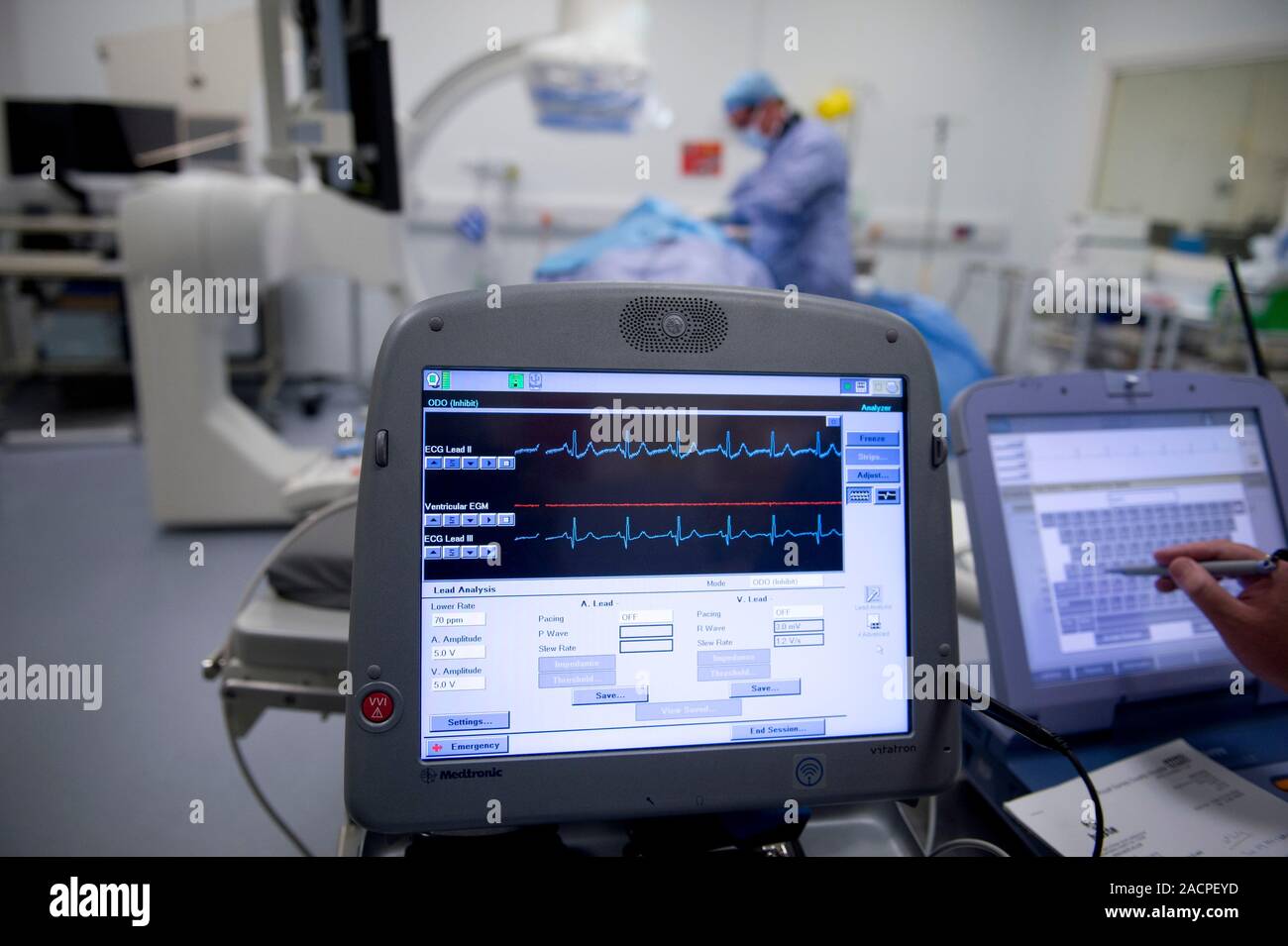 Implantable defibrillator surgery. Surgeons performing surgery to fit a