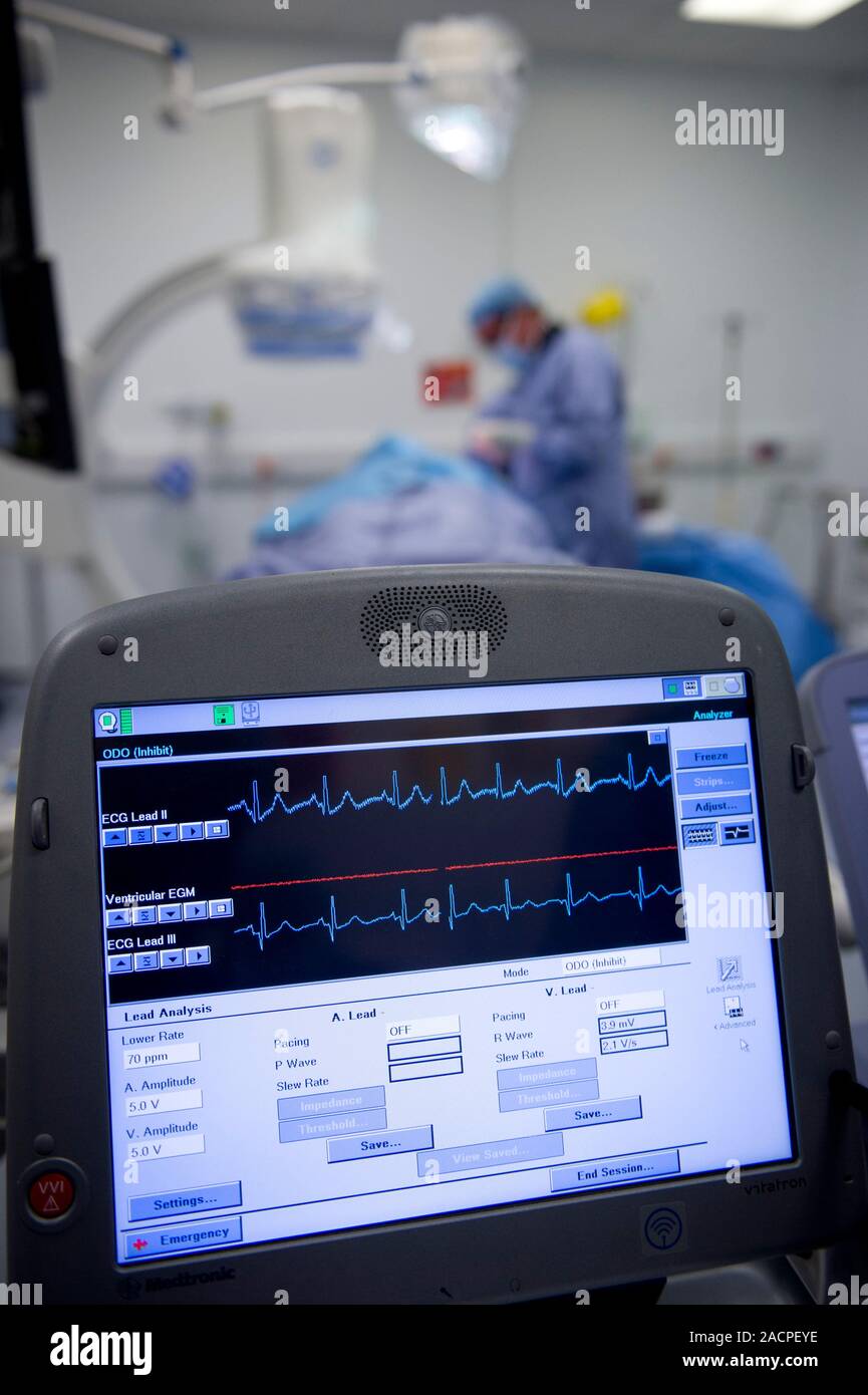 Implantable defibrillator surgery. Surgeons performing surgery to fit a