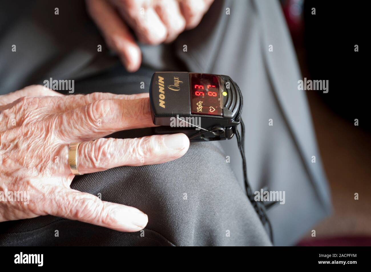 Community nursing. Close-up of a pulse oximeter on the finger of an 84 ...