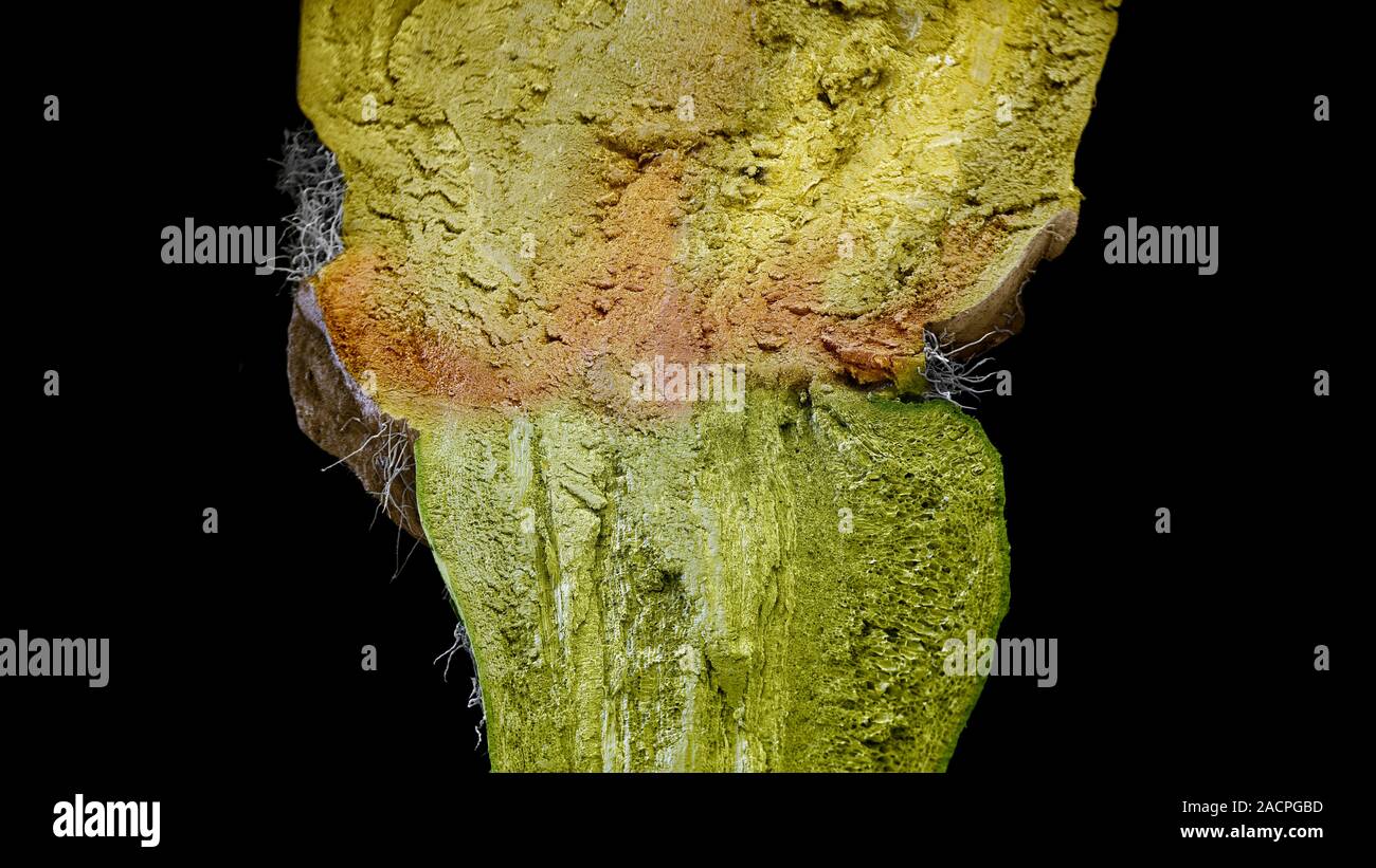 Apple stalk-branch junction. Coloured scanning electron micrograph (SEM) of a section through the junction between the stalk of an apple (lower half) Stock Photo
