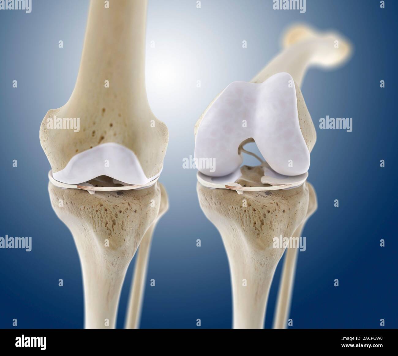 Knee flexion anatomy. Artwork of a frontal (anterior) view of the bones and some of the cartilage and ligaments of an extended (left) and flexed (righ Stock Photo