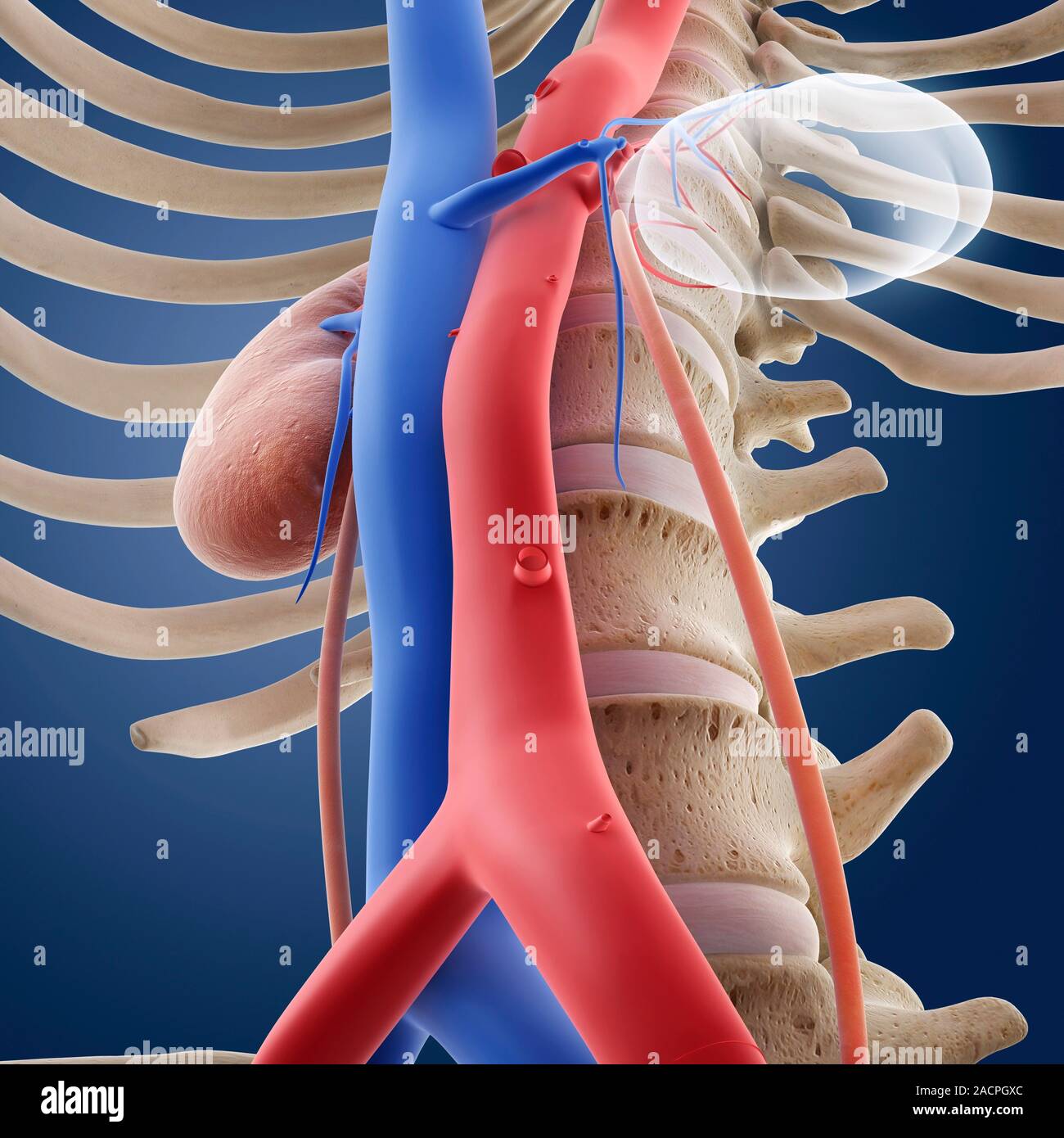 Singlekidney anatomy. Artwork showing an oblique rightfrontal view of