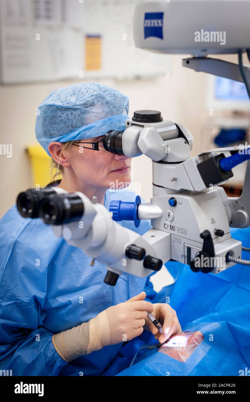 Cataract eye surgery. Surgeon carrying out an operation to remove a