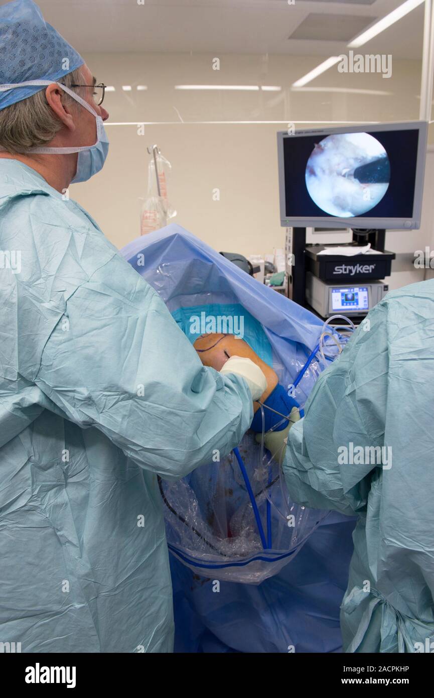 Shoulder arthroscopy. Surgeons viewing the interior of a female patient
