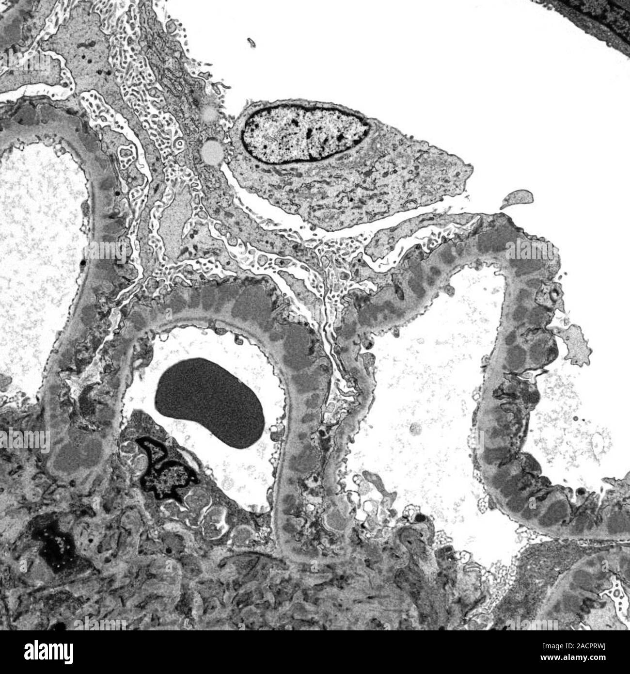 Kidney glomerulus. Transmission electron micrograph (TEM) of a section