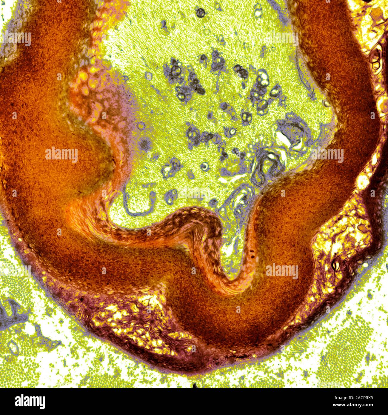 Myelinated nerve. Coloured transmission electron micrograph (TEM) of a ...