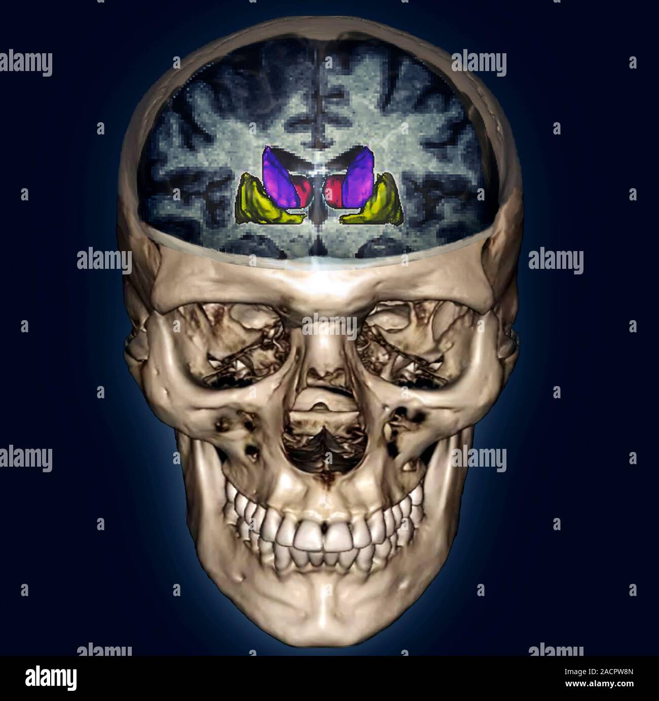Human head. Coloured composite image of a resonance imaging