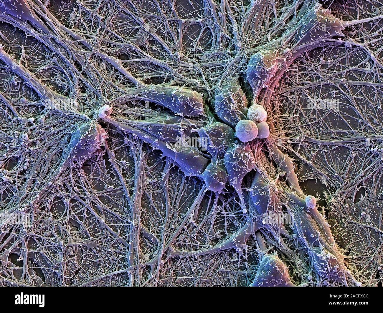 Neuron Electron Microscope Neuron Electron Microscope
