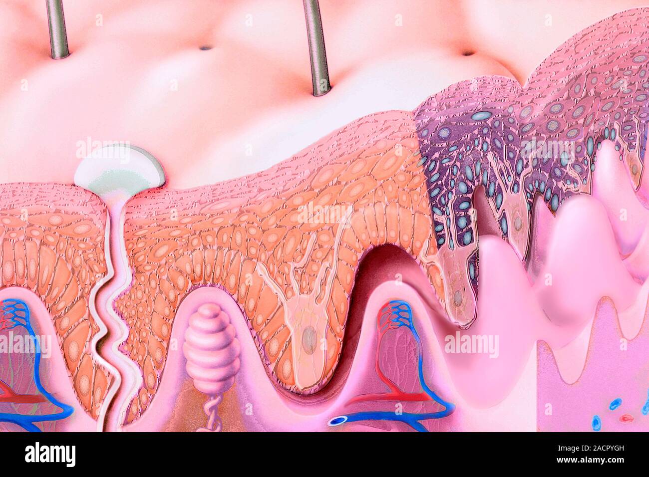 Skin Topic Skin structure. Computer artwork showing the different layers and ...