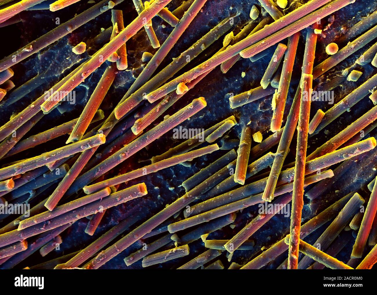 Carbon nanotubes. Coloured scanning electron micrograph (SEM) of carbon ...