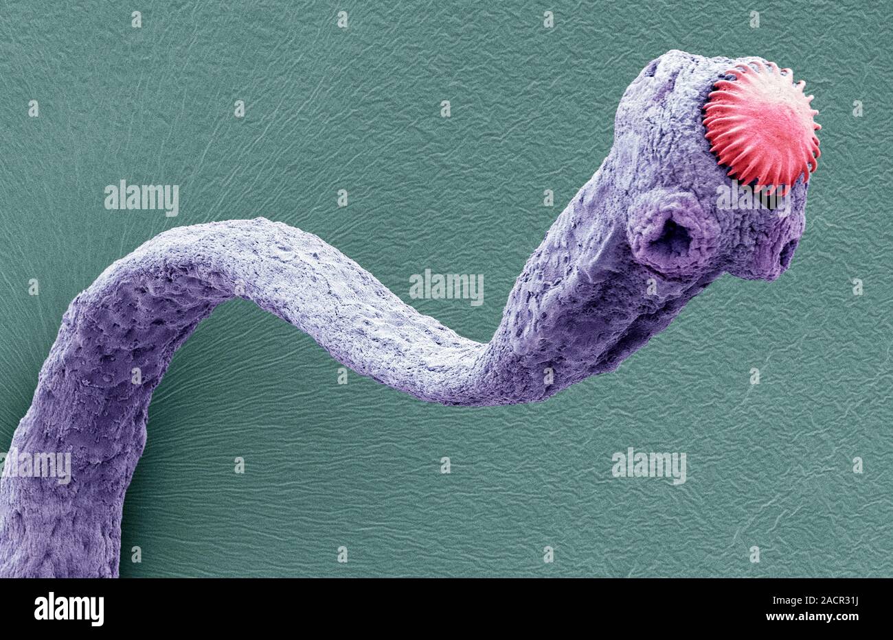 Tapeworm. Coloured scanning electron micrograph (SEM) of a tapeworm