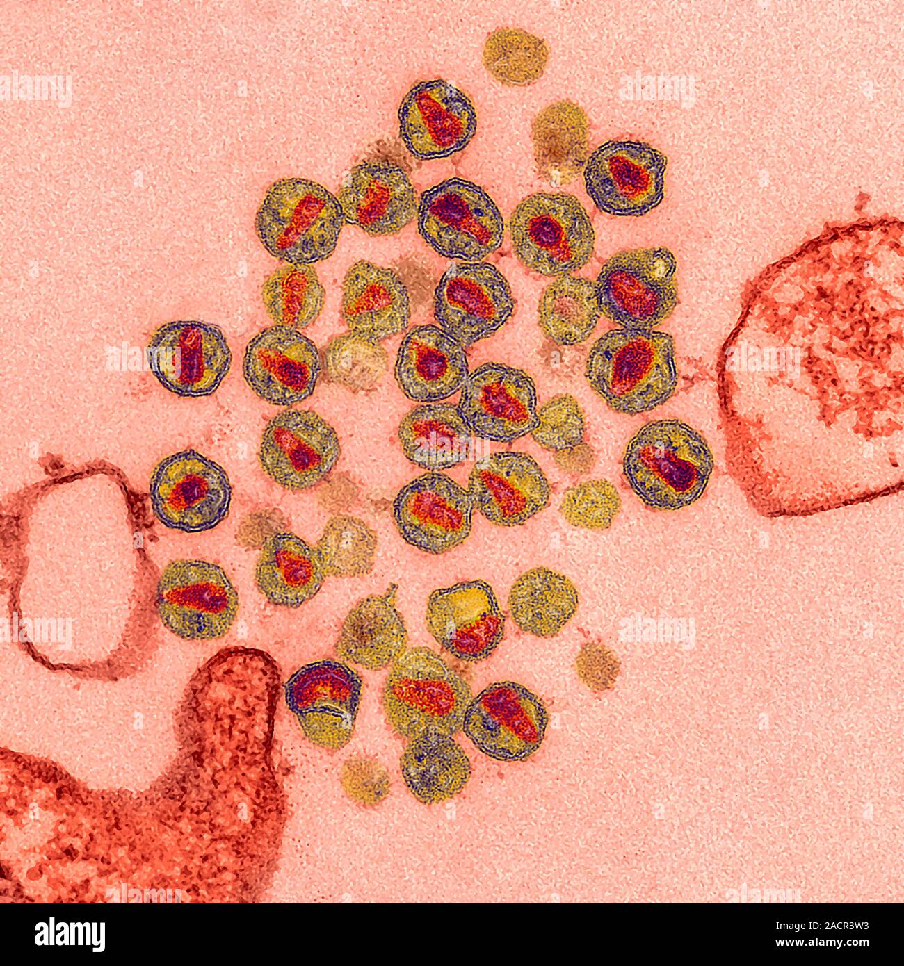 HIV virus particles. Transmission electron micrograph (TEM) of a