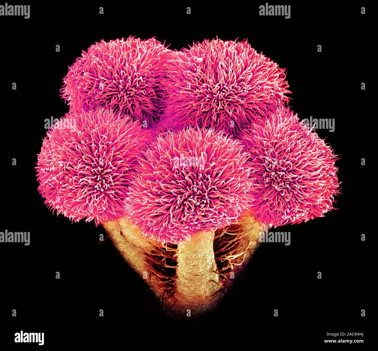 Hibiscus flower pistil. Coloured scanning electron micrograph (SEM) of ...