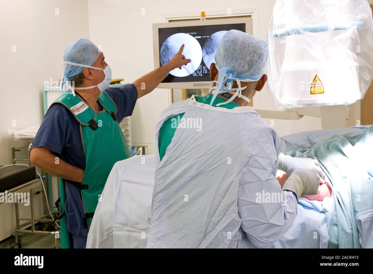 Knee arthroscopy. Surgeon using a keyhole arthroscopy (joint endoscopy) instrument to examine
