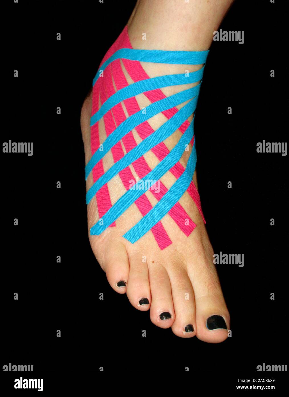 Taped sprained ankle. Closeup of elastic therapeutic tape (kinesio