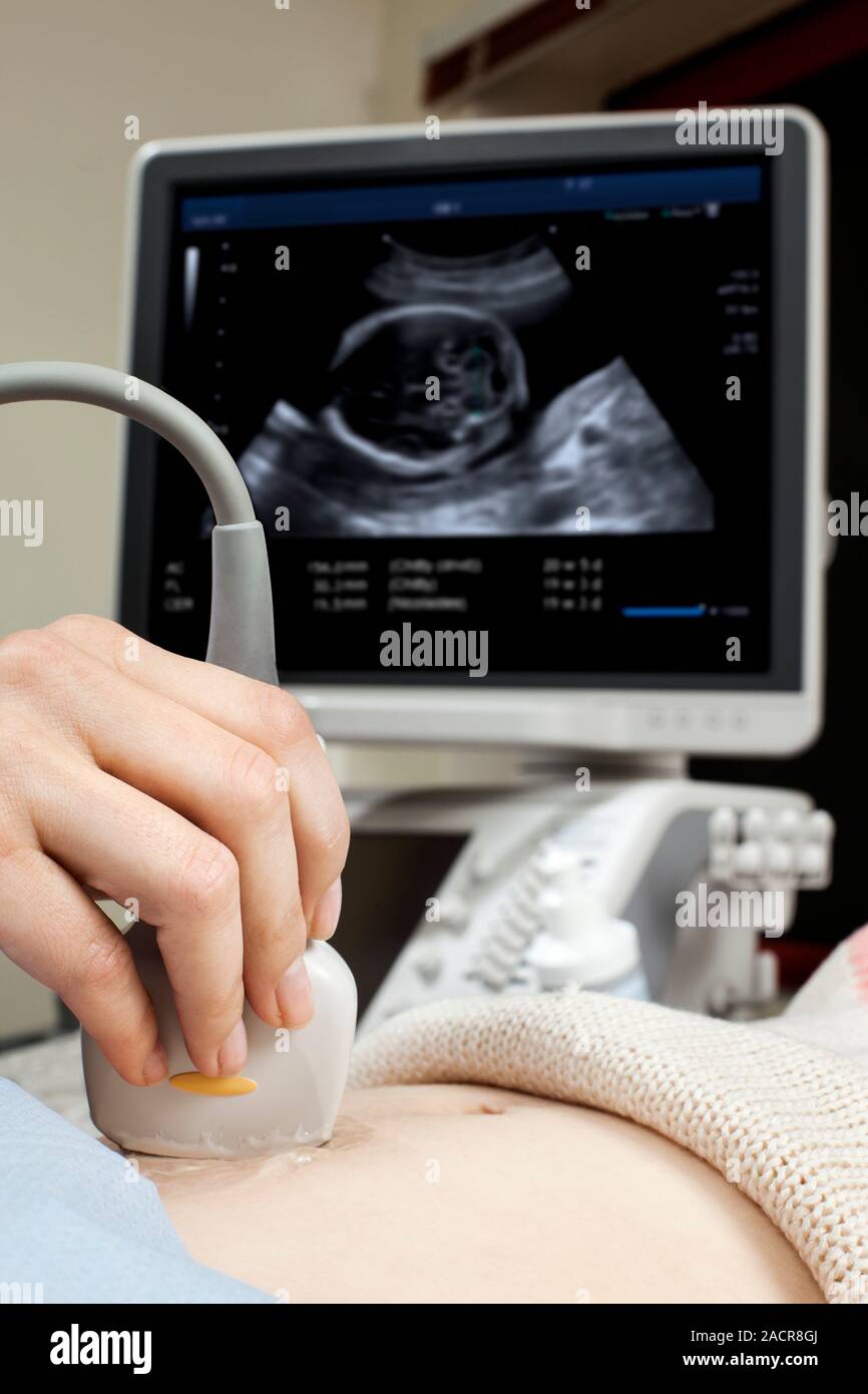 Ultrasound in pregnancy. Ultrasound transducer being used to scan the abdomen of a pregnant
