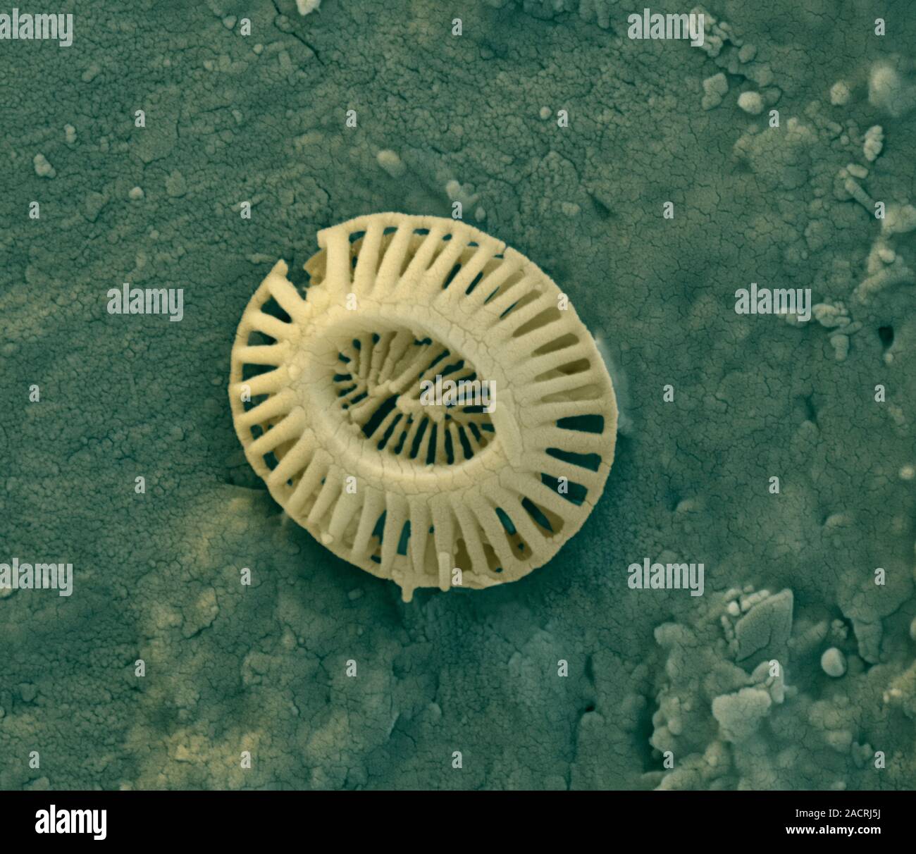 Diatom, coloured scanning electron micrograph (SEM). The diatoms are a ...