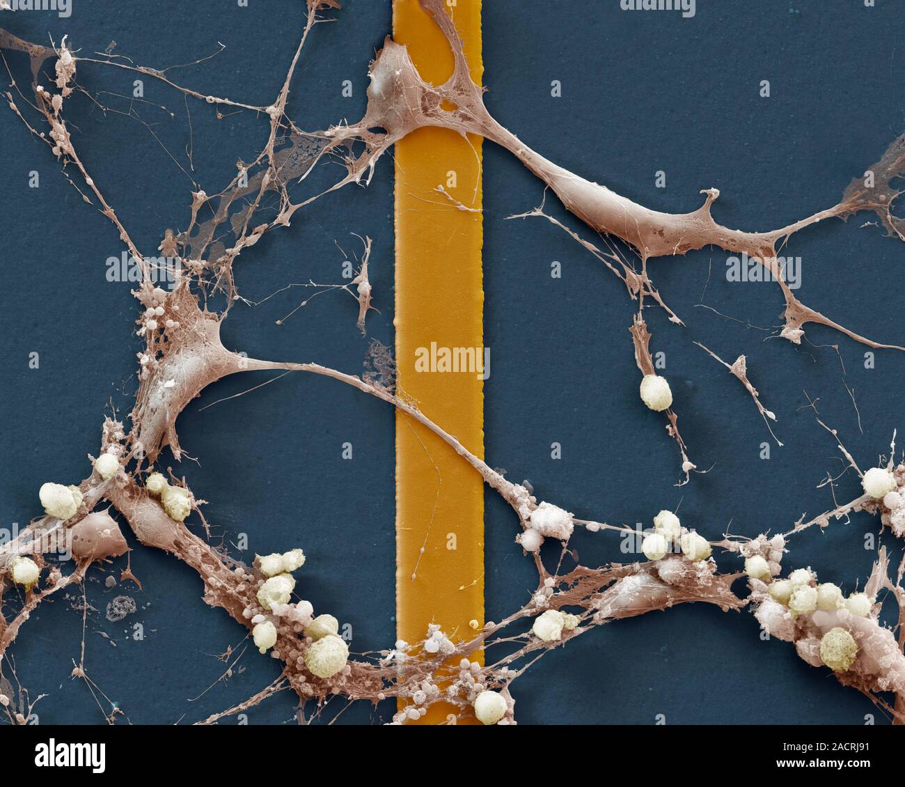 Nerve cells on a silicon chip. Coloured scanning electron micrograph ...
