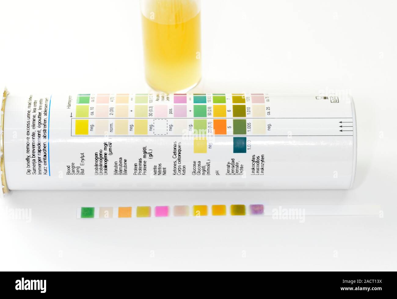 Not for use in Television Urine dipstick. Results of a urine dipstick