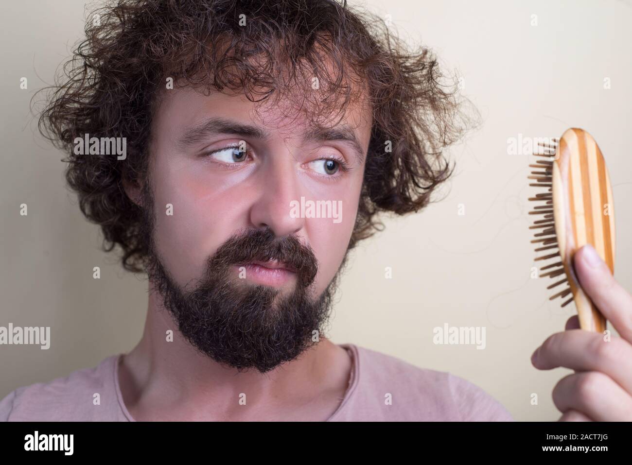 Portrait Of A Young Guy With Long Dirty Hair And Problematic Scalp