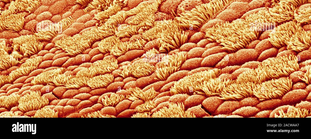 Nasal lining. Coloured scanning electron micrograph (SEM) of cilia ...
