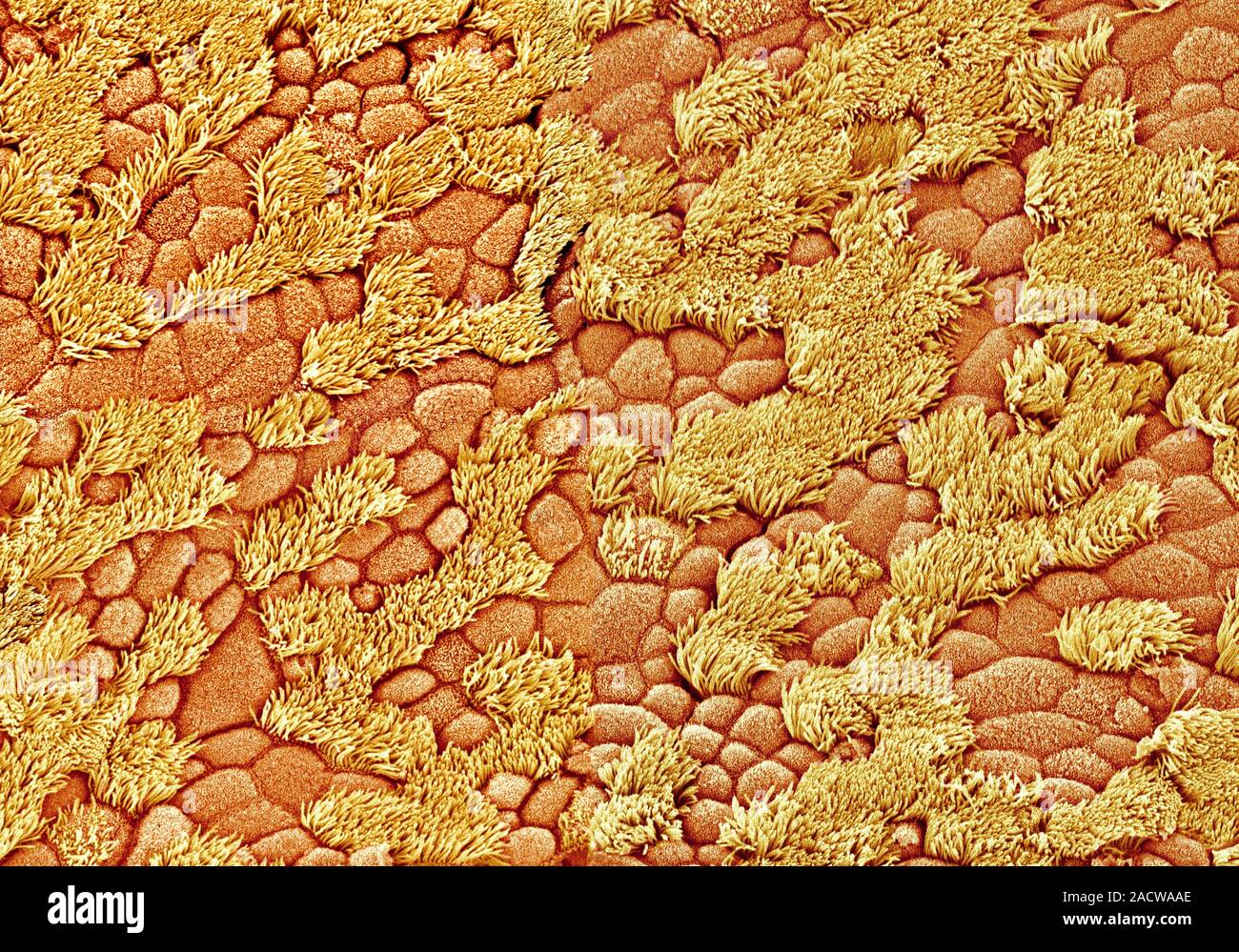 Nasal lining. Coloured scanning electron micrograph (SEM) of cilia ...