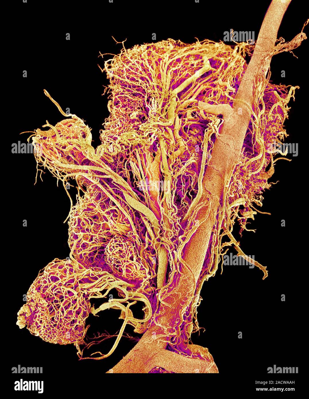 Blood vessels. Coloured scanning electron micrograph (SEM) of a resin ...