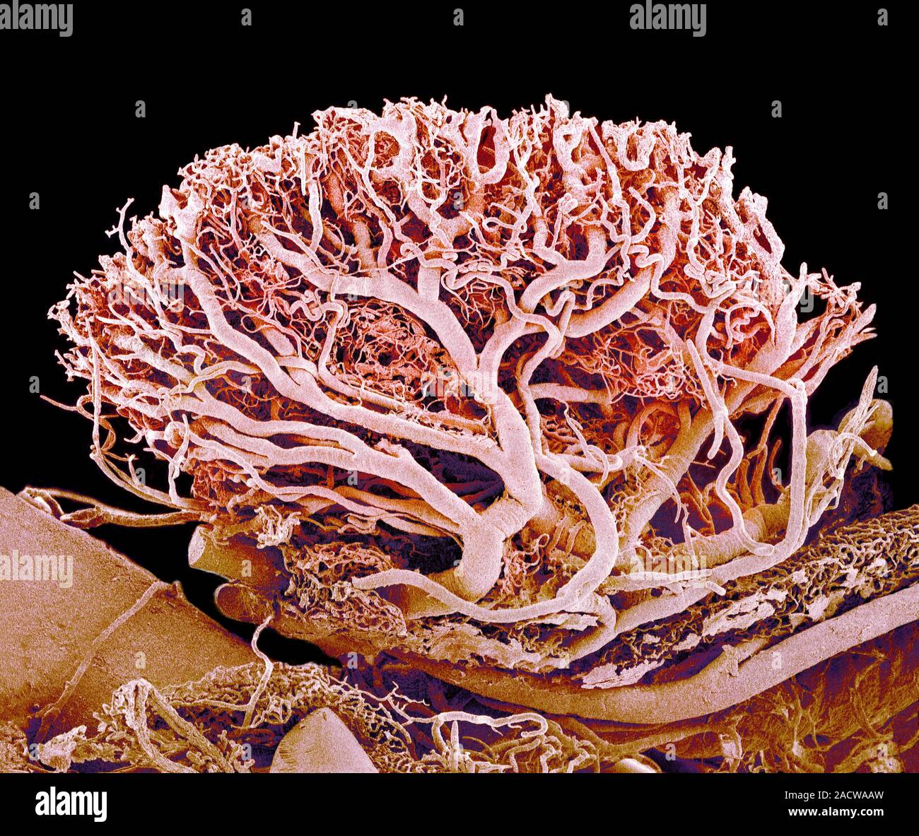 Blood vessels. Coloured scanning electron micrograph (SEM) of a resin ...
